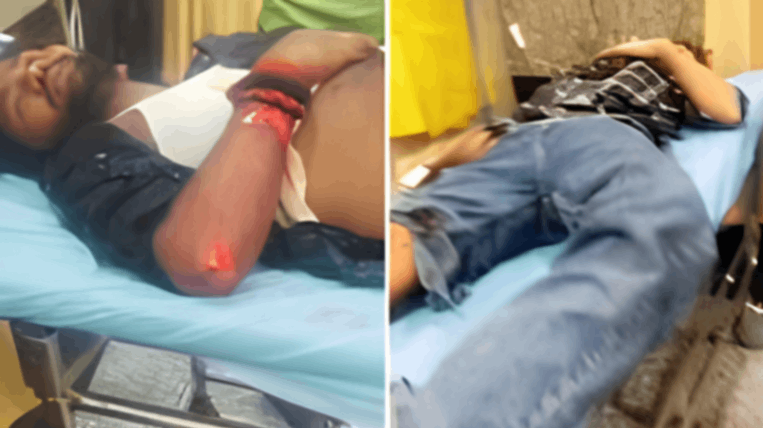 कार की टक्कर से हवा में उड़े बाइक सवार, फ्लाईओवर से मकान की छत पर गिरा युवक...