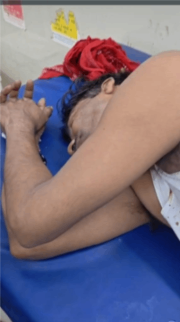 चाकूबाजी में घायल युवक ने  तीन दिन बाद तोड़ा दम, अस्पताल में भर्ती आरोपित हिरासत में