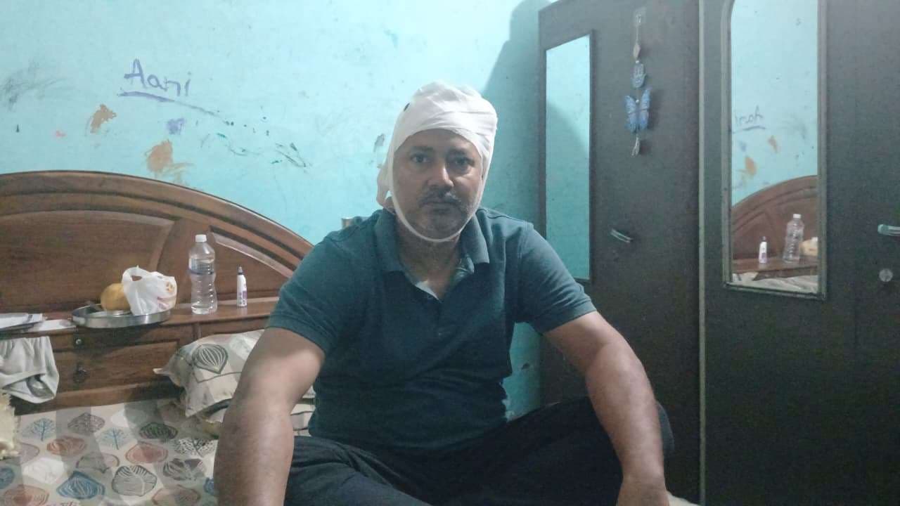 बीएचयू कर्मचारी पर बैट से हमला, बीच-बचाव पड़ा भारी; एक गिरफ्तार, अन्य की तलाश...