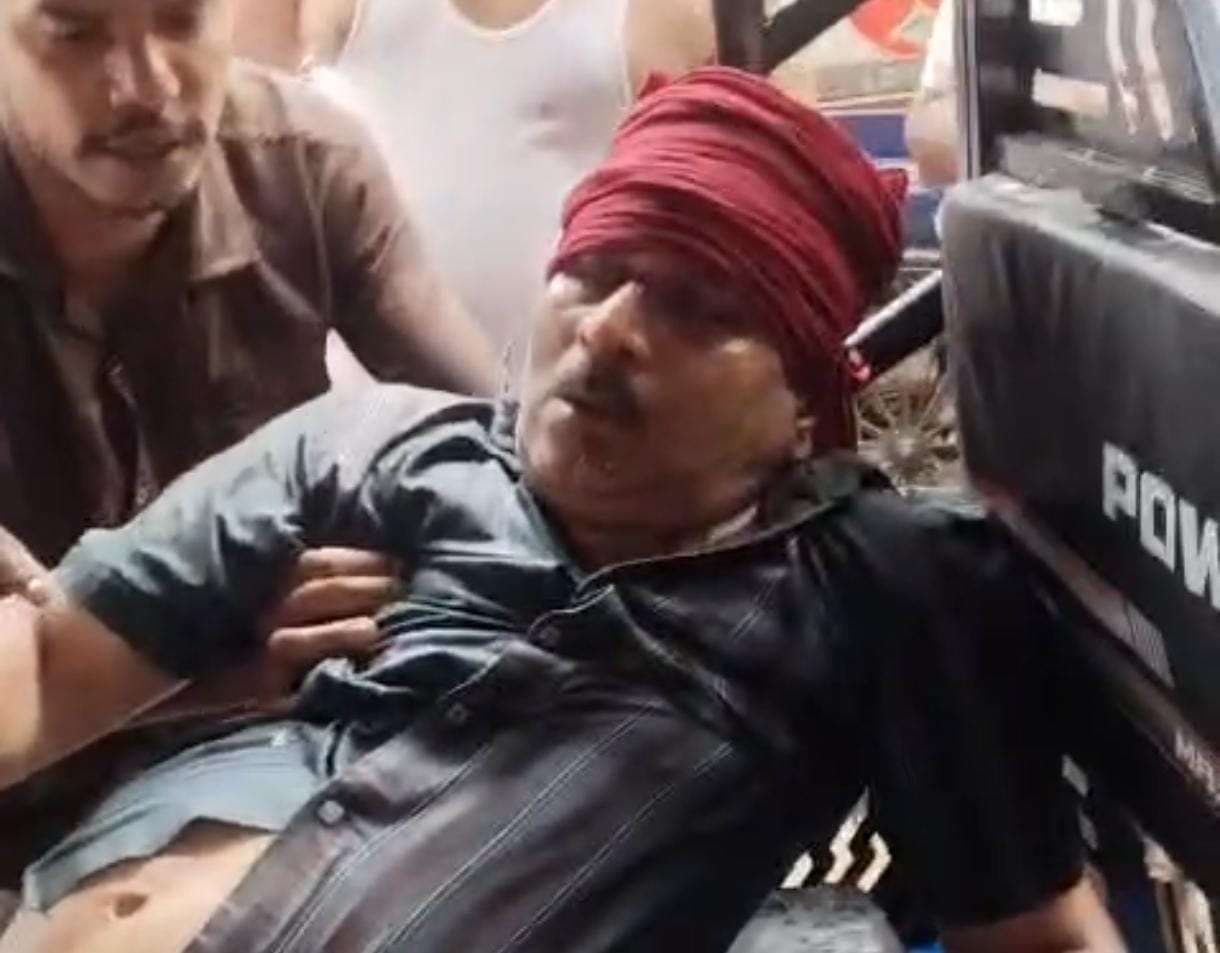 दालमंडी में ईंट गिराने से दुकानदार गंभीर घायल, ट्रॉमा सेंटर में भर्ती...