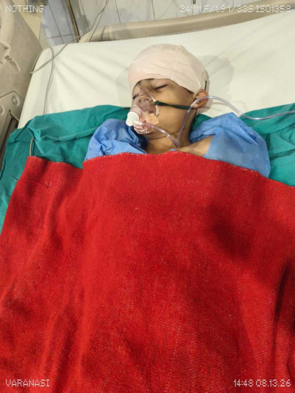 बीएचयू परिसर में प्रोफेसर के कुत्ते ने मासूम का सिर व चेहरा नोच डाला, लगे 50 टांके 